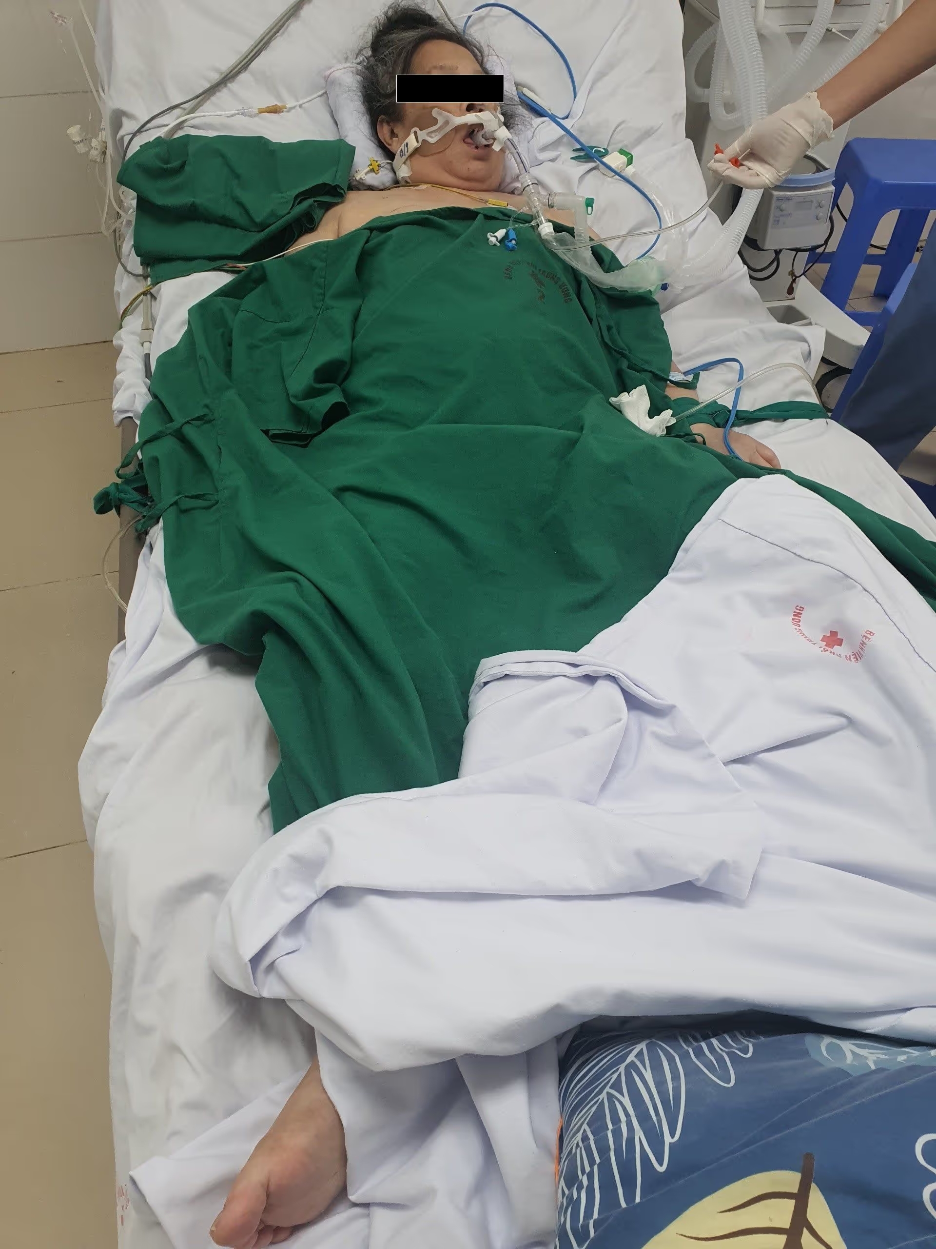 Vai trò của dinh dưỡng cho người bệnh điều trị Hồi sức tích cực