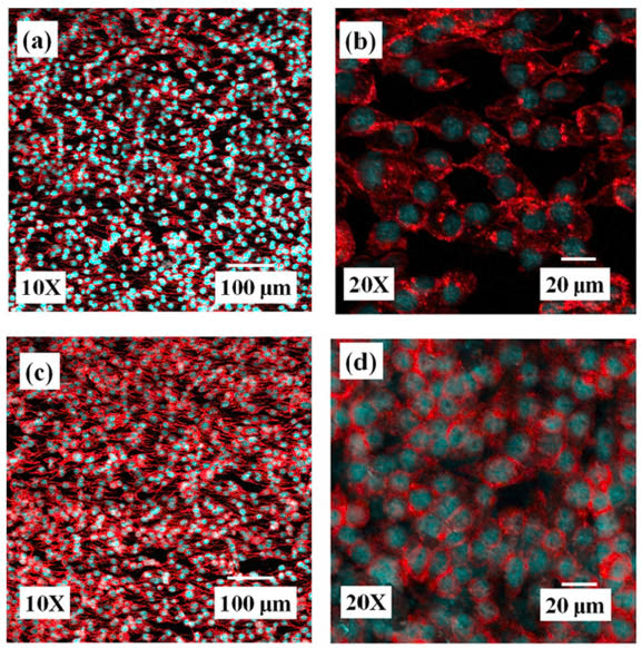 NGHIÊN CỨU PHÁT TRIỂN CHI TIẾT CẤY GHÉP Y SINH PHỤC VỤ NHU CẦU NỘI ĐỊA HÓA