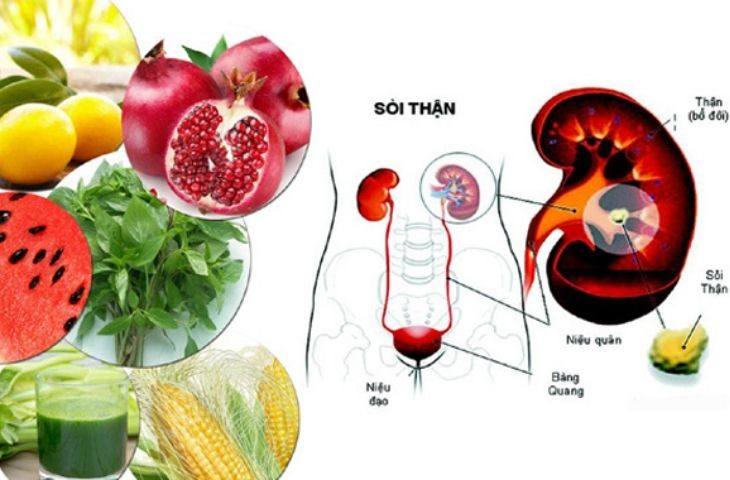 Bệnh nhân sỏi thận nên ăn gì để nhanh chóng đẩy lùi bệnh?
