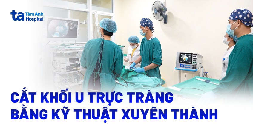 Cắt triệt để khối u trực tràng bằng kỹ thuật xuyên thành