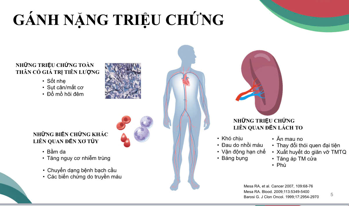 Xơ tủy: Lời khuyên vàng từ chuyên gia huyết học
