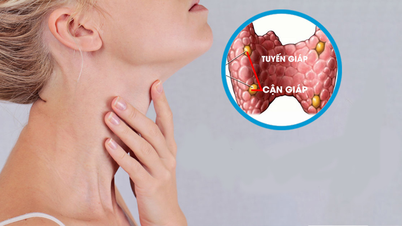 Tăng Canxi máu: Bệnh lý nguy hiểm nhưng dễ bị bỏ sót