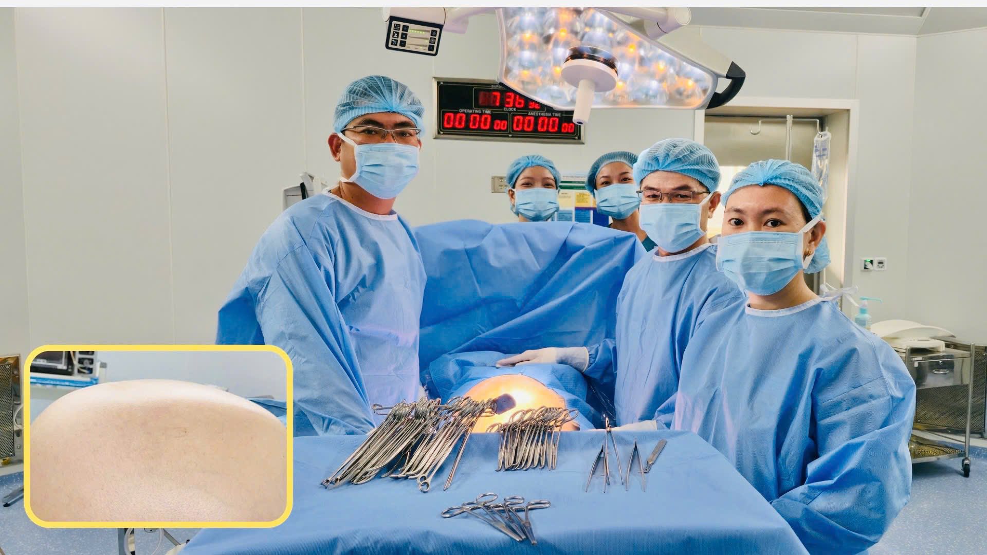 Lấy khối u buồng trứng nặng 20kg – to nhất từ trước đến nay tại Bệnh viện Từ Dũ