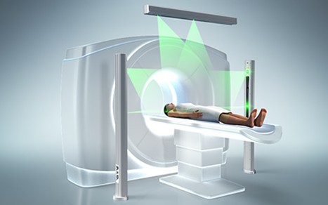 Mô phỏng trong xạ trị