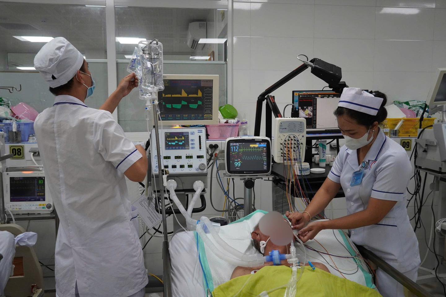 ĐIỆN NÃO ĐỒ VIDEO – BƯỚC TIẾN MỚI TRONG CHẨN ĐOÁN VÀ ĐIỀU TRỊ BỆNH ĐỘNG KINH