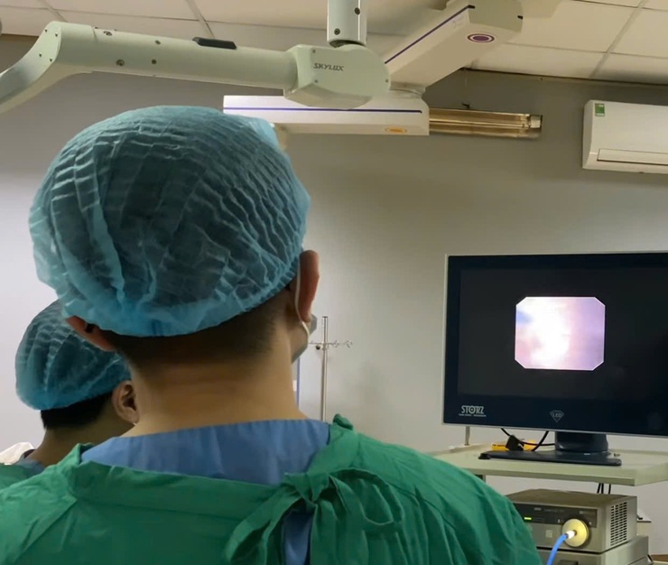 Bệnh viện đa khoa Phú Xuyên đưa vào sử dụng máy tán sỏi công nghệ laser hiện đại