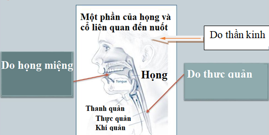 Cảm giác nuốt vướng là dấu hiệu bệnh gì?