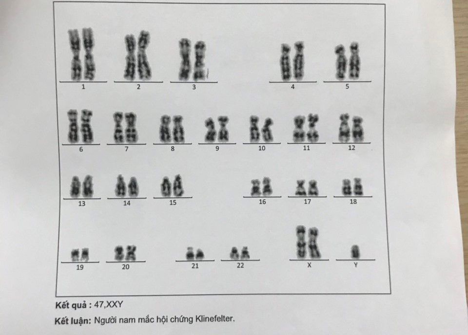 Hội chứng Klinefelter