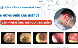Bệnh viện đa khoa Hòe Nhai khuyến cáo phòng ngừa viêm tai ngoài do nấm