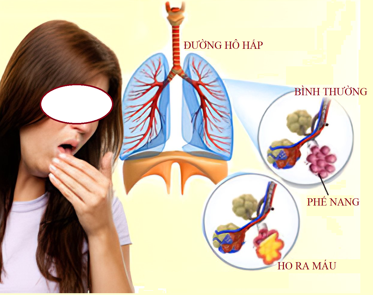 Thông tin hữu ích cho người có biểu hiện ho ra máu