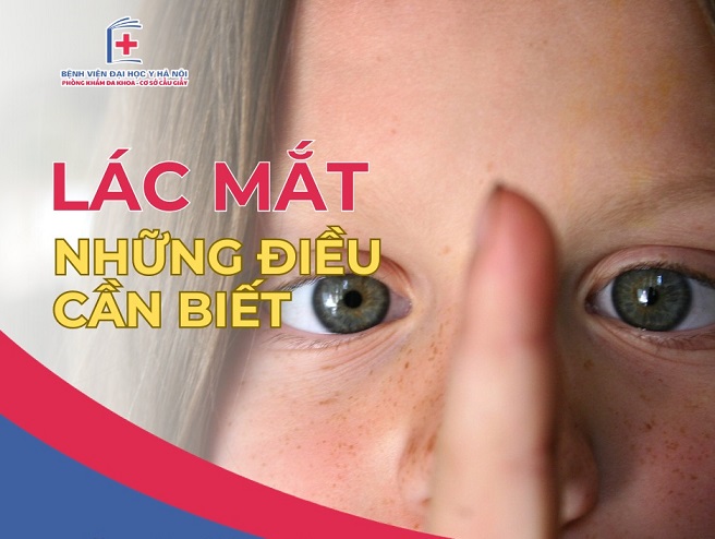 Lác mắt – những điều cần biết