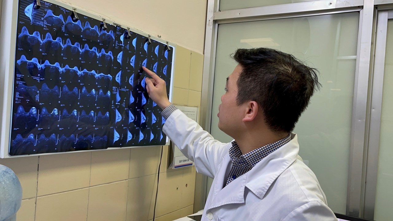 Phát hiện và phòng tránh áp xe vú ở người không cho con bú