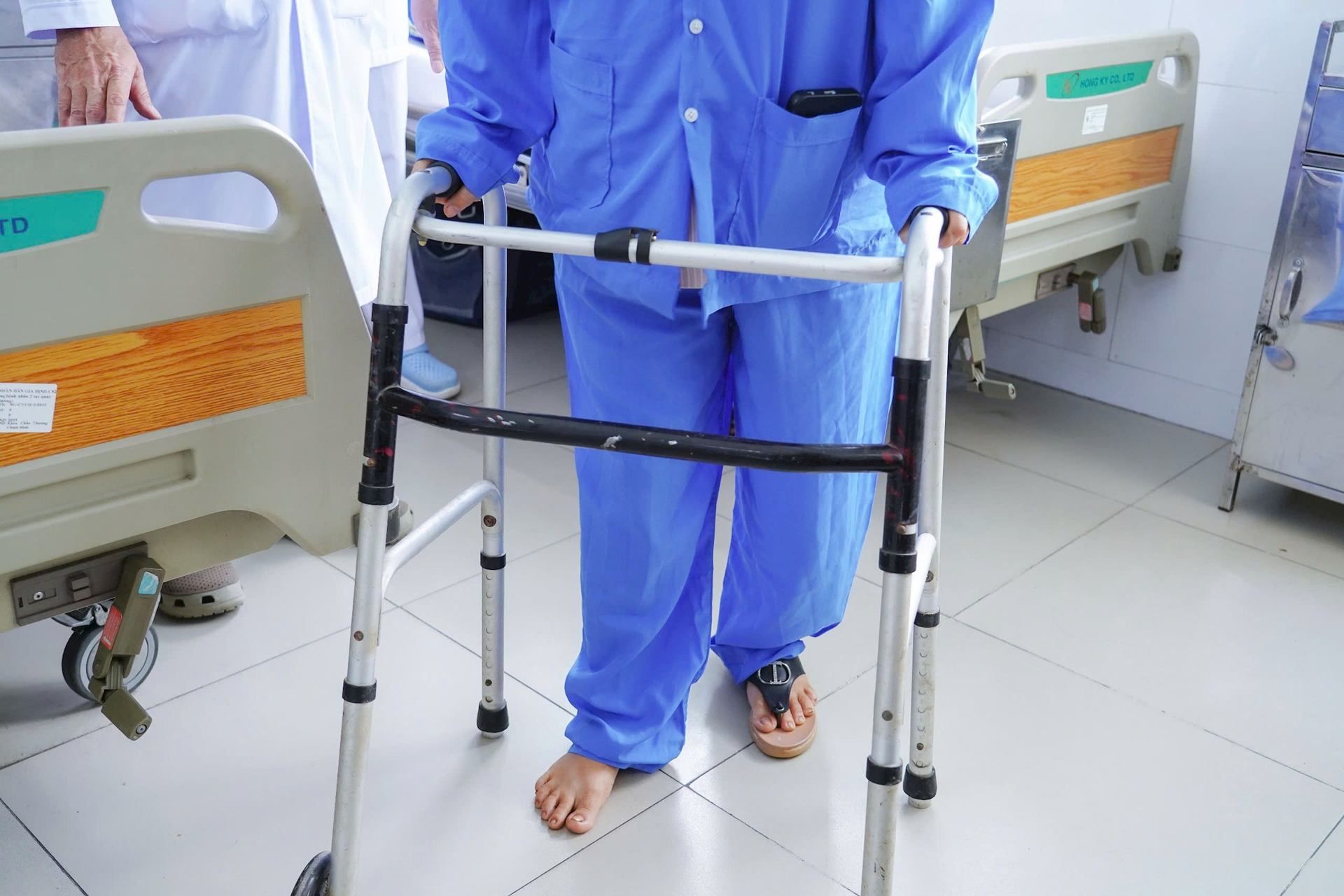 Bệnh viện Nhân dân Gia Định cơ sở 2: Thay khớp háng toàn phần cho bệnh nhân bị lệch khớp háng gần 40 năm