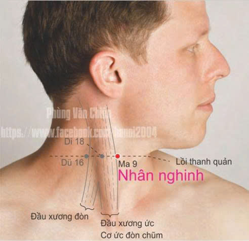 Châm cứu làm đẹp