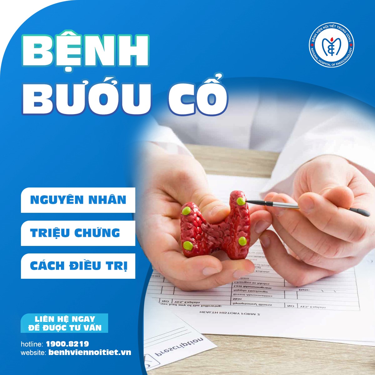 Bệnh bướu cổ: nguyên nhân, triệu chứng và cách điều trị