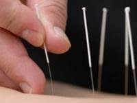 Chữa mất ngủ kinh niên bằng châm cứu