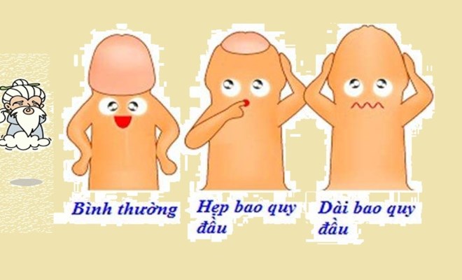 Hẹp bao quy đầu – những điều cần biết
