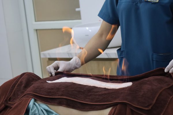 HIỆU QUẢ TRIỂN KHAI KỸ THUẬT “HỎA LONG CỨU” TẠI BỆNH VIỆN Y HỌC CỔ TRUYỀN THÁI BÌNH