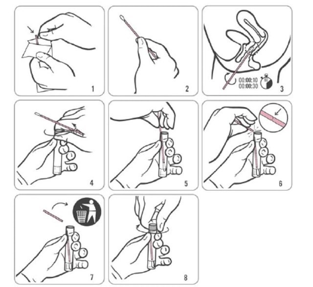 Liên cầu khuẩn nhóm B ảnh hưởng đến trẻ sơ sinh như thế nào?