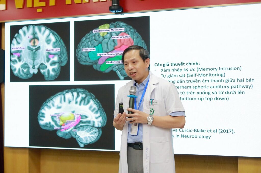 Kích thích từ xuyên sọ: Hy vọng mới cho bệnh nhân tâm thần phân liệt thoát khỏi ảo thanh