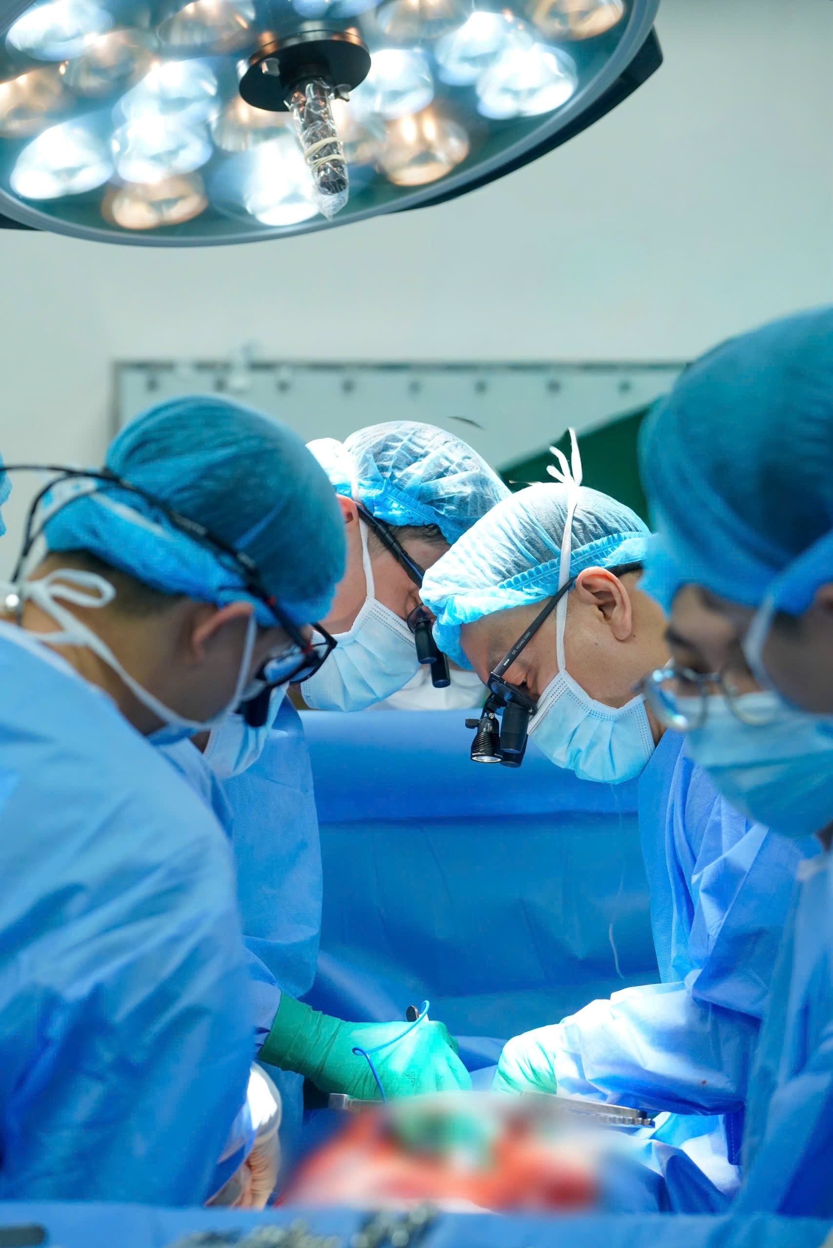 Phẫu thuật thành công sỏi tuyến dưới hàm kích thước lớn cho bệnh nhân