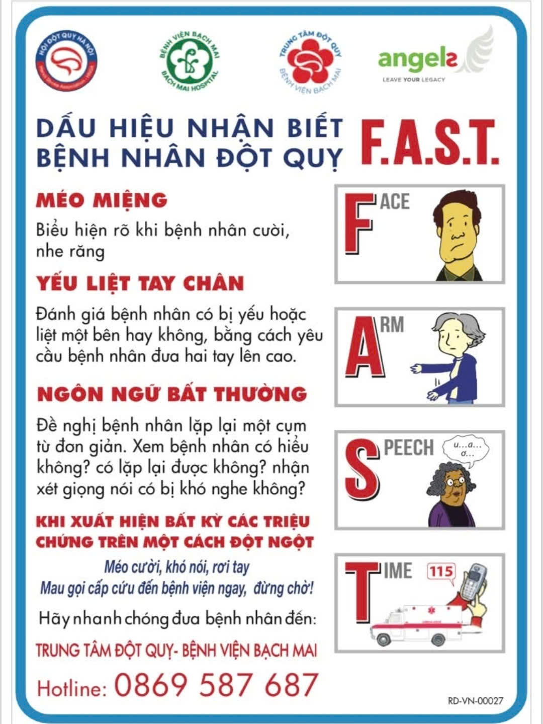 Đột quỵ: Đừng để những “tín hiệu lạ” trở thành bi kịch