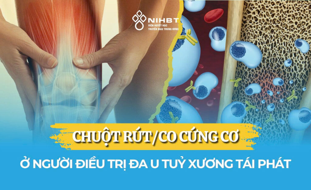 Xử trí khi bị chuột rút, co cứng cơ ở người điều trị đa u tuỷ xương tái phát