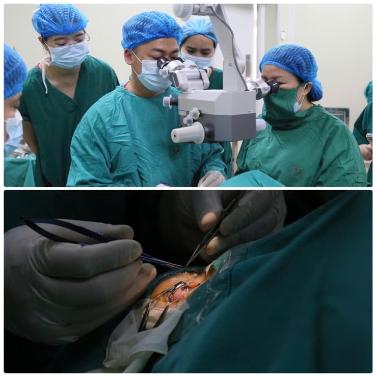 Bệnh viện đa khoa Đức Giang: Lần đầu triển khai kỹ thuật ghép giác mạc xuyên, tiến tới làm chủ ghép đa tạng