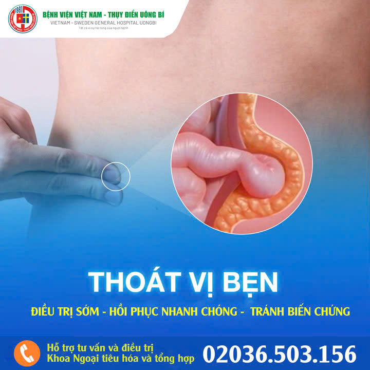 Người đàn ông hoại tử ruột do thoát vị bẹn nghẹt